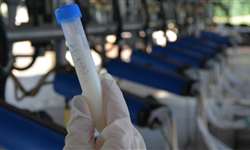 Vale a pena o congelamento de amostras de leite antes da cultura microbiológica?
