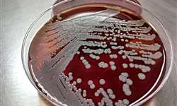 Padrão de resistência aos antimicrobianos de Staphylococcus aureus - análise histórica