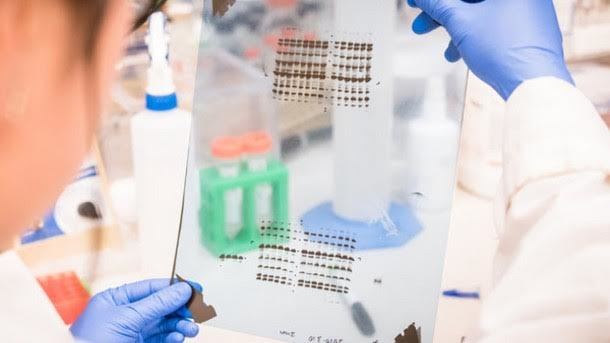 raio x - mineração - sódio - queijos 